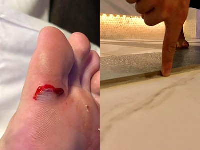 摩鐵浴室藏利刃！台中女「踢到磁磚」腳掌劃開爆血　服務生：貼OK繃