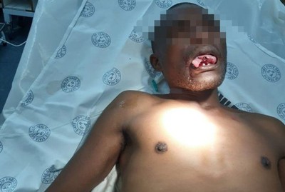 南非女醫師被狼吻險遭性侵　死命抵抗咬斷他舌頭！