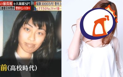 親媽嫌棄「長很醜」 心碎女砸千萬整型300次變「怪獸」