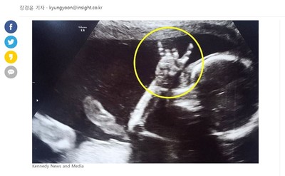 胎教播「古典+流行樂」　超音波照到24周女嬰超嗨比ROCK！
