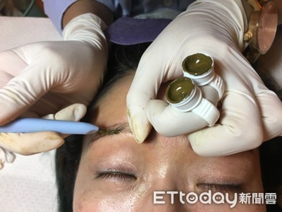 飄霧眉每天可多睡10分鐘 「這體質」亂試恐讓臉長出毛毛蟲