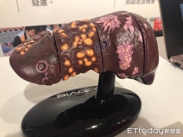 肝,肝臟,肝炎。（圖／記者趙于婷攝）