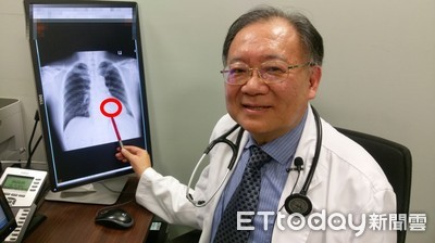 心跳慢到剩30下！男靠「0.8c.c膠囊版」心臟節律器重拾運動