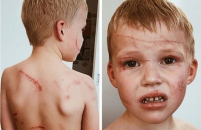 2米高袋鼠發狂襲擊5歲男童　父：他快被打死了
