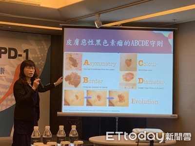 腳上黑痣如「滿天星」!洗澡搓不掉 50多歲男確診皮膚癌