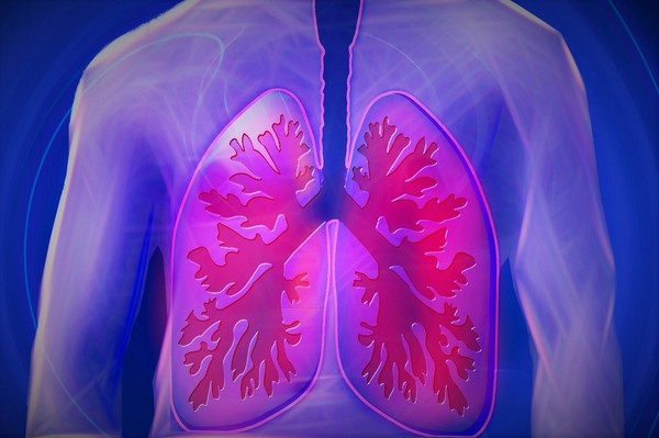 ▲脂肪肺。（圖／Pixabay）
