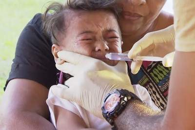 薩摩亞麻疹危機63死　反疫苗論者鼓吹「木瓜葉療法」被捕