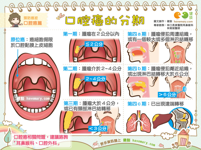 口腔癌发病原因图片