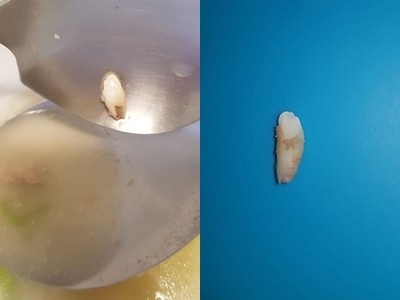 喝骨仔肉湯「吃到牙齒」!媽一陣嘔吐確認:不是我的 ... 網淡定解答喊正常