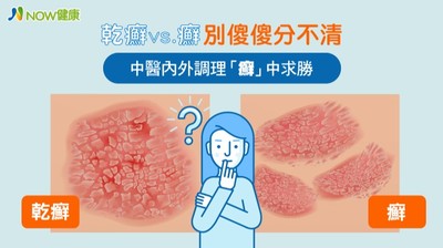 「乾癬」不是「癬」！　中醫師詳解兩者不同之處