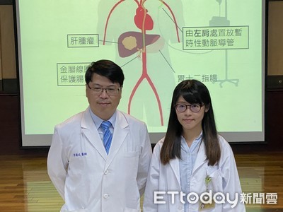 肝癌末期轉移腹膜　肝動脈化療+手術治療打開「活路」！