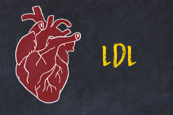 ▲血液檢測、LDL、壞膽固醇、心臟、血壓。（示意圖／123RF）