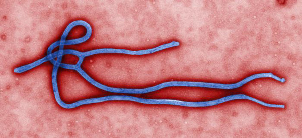 伊波拉病毒长什么样图片