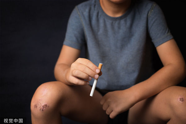 ▲▼。（圖／CFP）