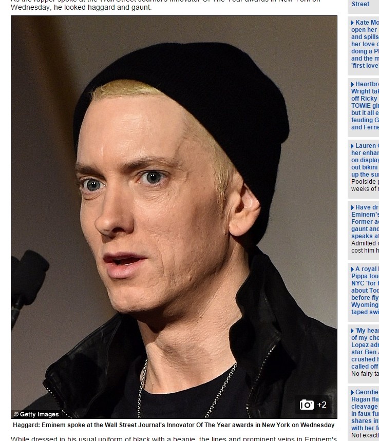 吸毒留后遗症?42岁阿姆皮皱脸垂 突现憔悴老态