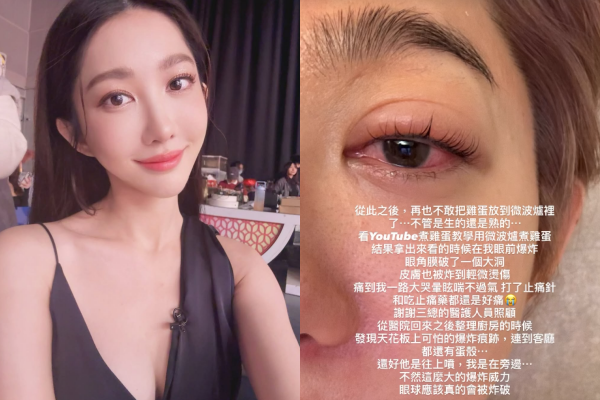 ▲王晴微波雞蛋炸傷眼「流理台也炸碎」。（圖／翻攝自Instagram／serena_wang_qing）