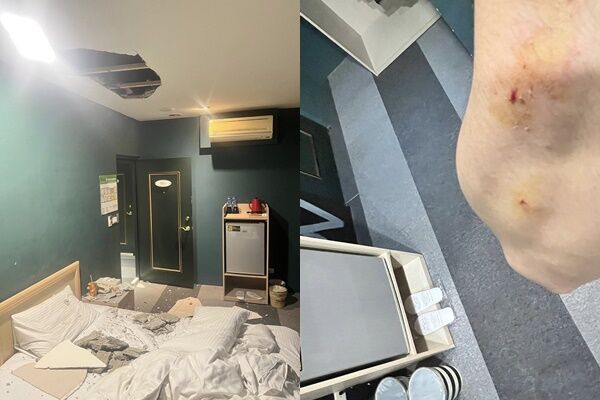 商旅「天花板水泥掉落」砸傷他　妻氣炸：想當沒事？業者道歉了